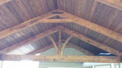 Cedar Craftsman Patio Cover Kit 5 small